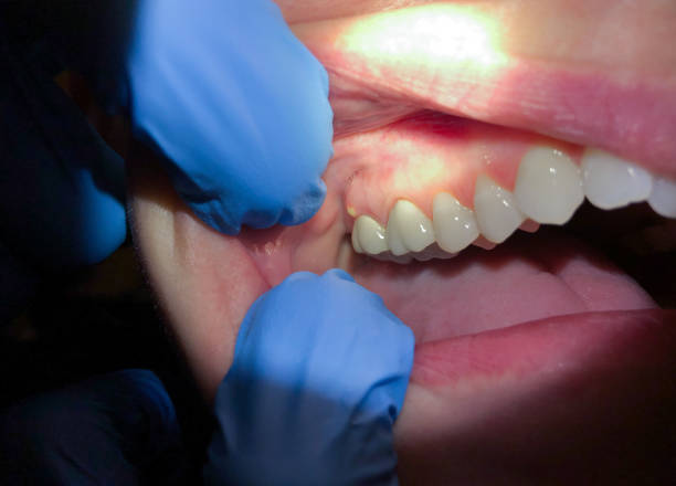 Best Walk-In Emergency Dentist in South Connellsville, PA